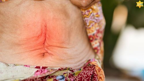 Phòng bệnh giúp tiết kiệm chi phí