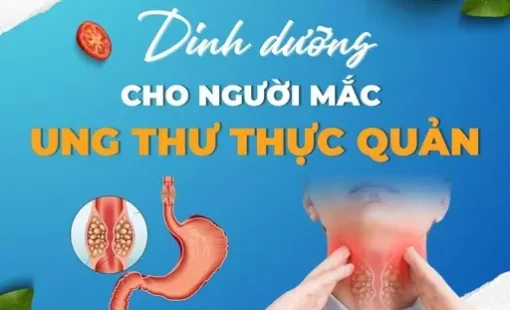 DInh dưỡng cho người mắc ung thư thực quản