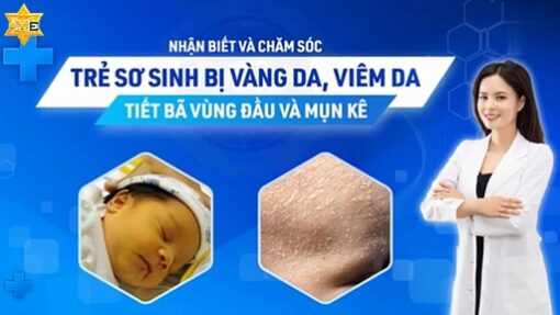 Nhận biết và chăm sóc trẻ sơ sinh bị vàng da, viêm da tiết bã vùng đầu và mụn kê
