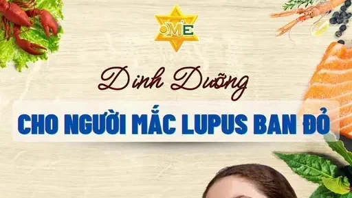 Dinh dưỡng cho người mắc lupus ban đỏ Dinh dưỡng cho người mắc lupus ban đỏ
