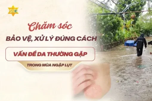 Chăm sóc, bảo vệ, xử lý đúng cách vấn đề da thường gặp trong mùa ngập lụt