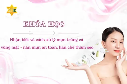 Nhận biết và cách xử lý mụn trứng cá vùng mặt - nặn mụn an toàn, hạn chế thâm sẹo Nhận biết và cách xử lý mụn trứng cá vùng mặt - nặn mụn an toàn, hạn chế thâm sẹo