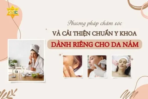 Phương pháp chăm sóc và cải thiện chuẩn y khoa dành riêng cho da nám